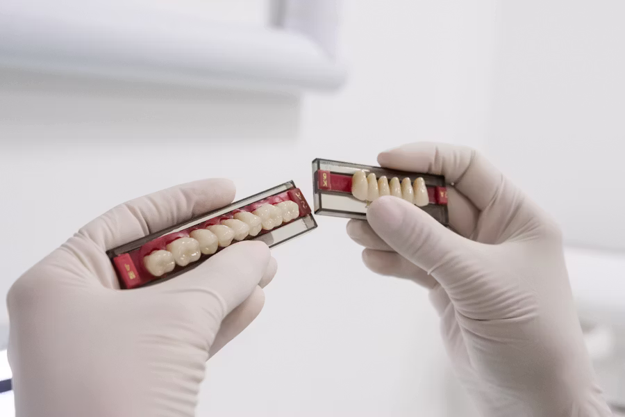Cura dell'impianto dentale — Studio Dentistico Bruno Appi