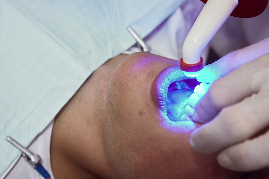 Sbiancamento denti professionale in studio — Studio Dentistico Bruno Appi