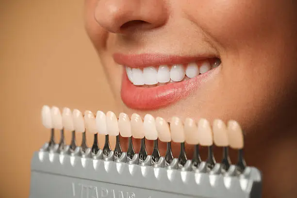 Sorriso perfetto con trattamenti di estetica dentale — Studio Dentistico Bruno Appi